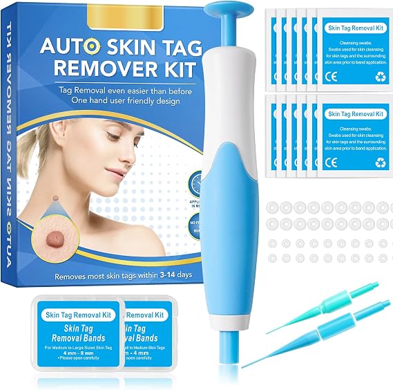 Skin Tag Removal Kit, Auto Skin Tag Remover Pen Kit for All Skin Types, Easy & Fast Remover Wart & Mole - 40 Bands & 10 Cleansing Wipes for Face & Body (1 Pen)