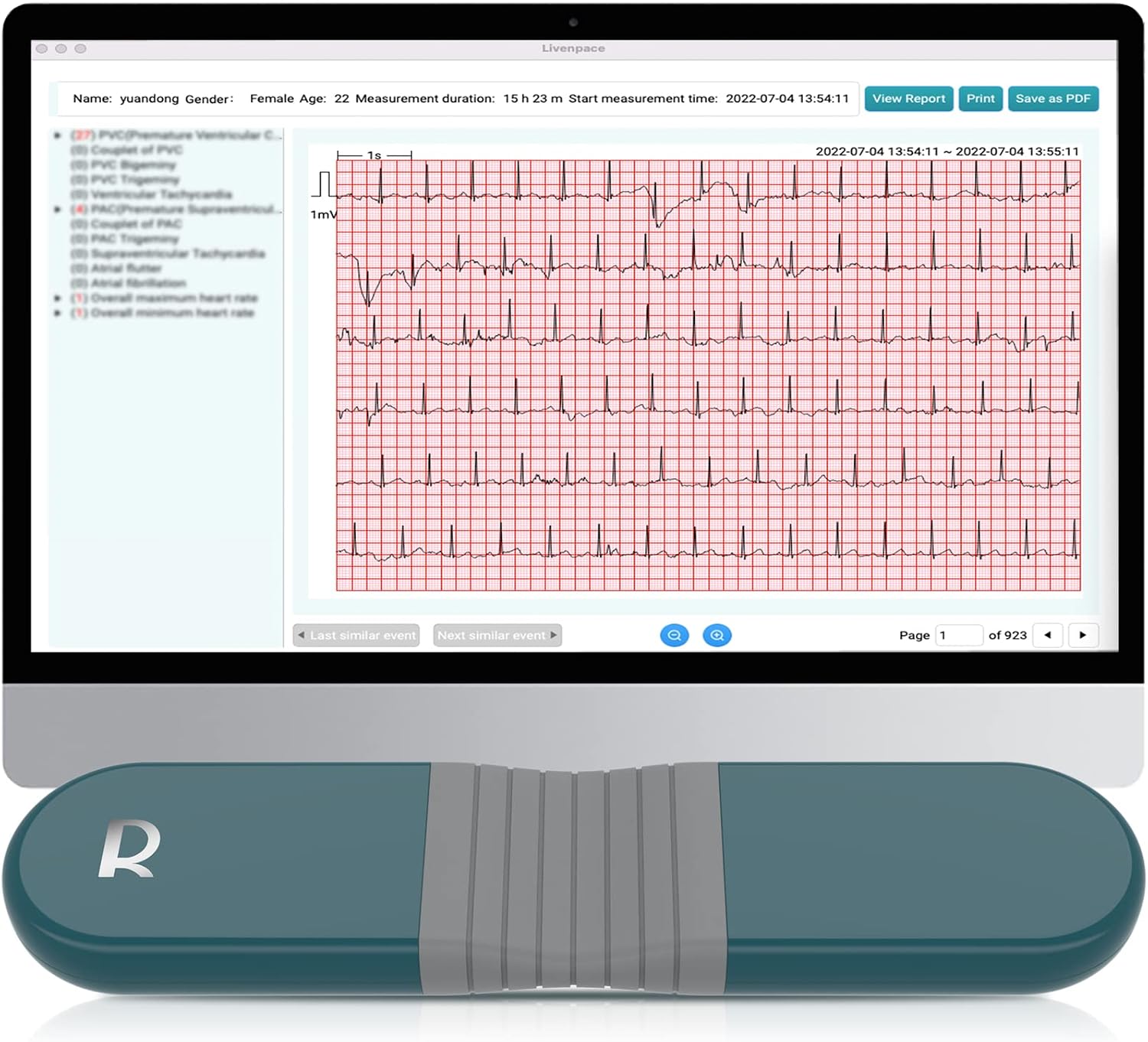 AI HR Monitor, E K G Monitor, 24 Hours Chest Lead Device with Free AI Analysis & PC Report, Chargeable Recorder, HHM1